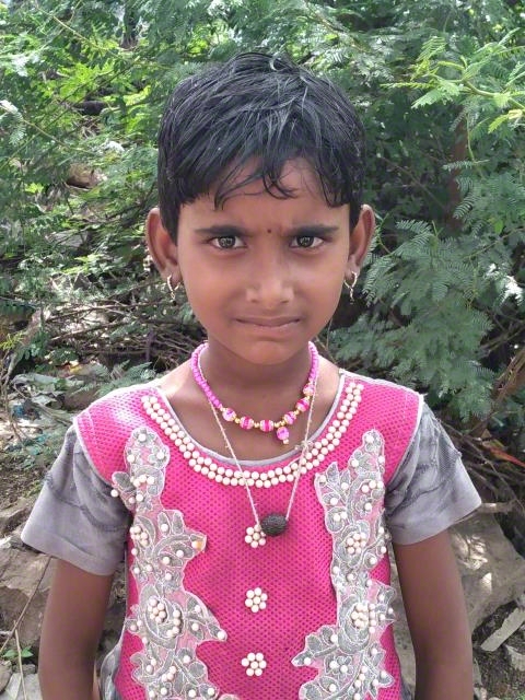 World Vision India